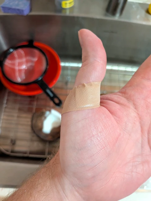 Skep’s left hand splayed out palm-up over the kitchen sink, with a band-aid around the base of his thumb.